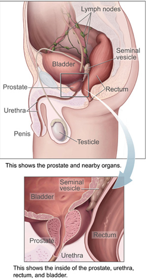 Diagram of the Prostate Gland